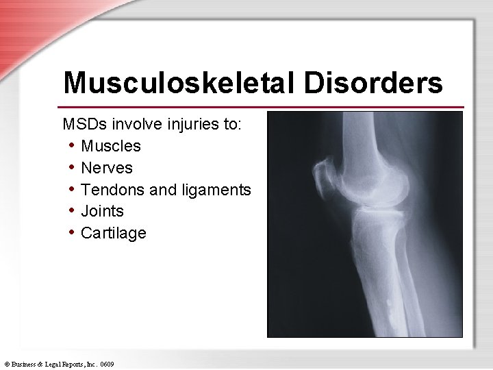 Musculoskeletal Disorders MSDs involve injuries to: • Muscles • Nerves • Tendons and ligaments