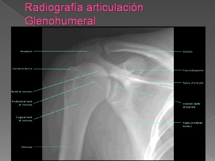 Radiografía articulación Glenohumeral 