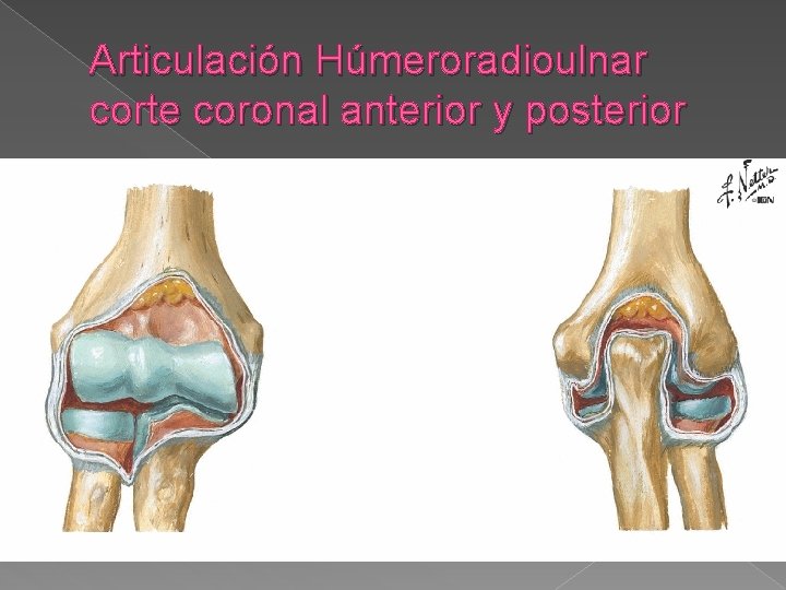 Articulación Húmeroradioulnar corte coronal anterior y posterior 