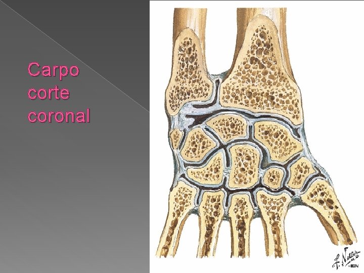 Carpo corte coronal 