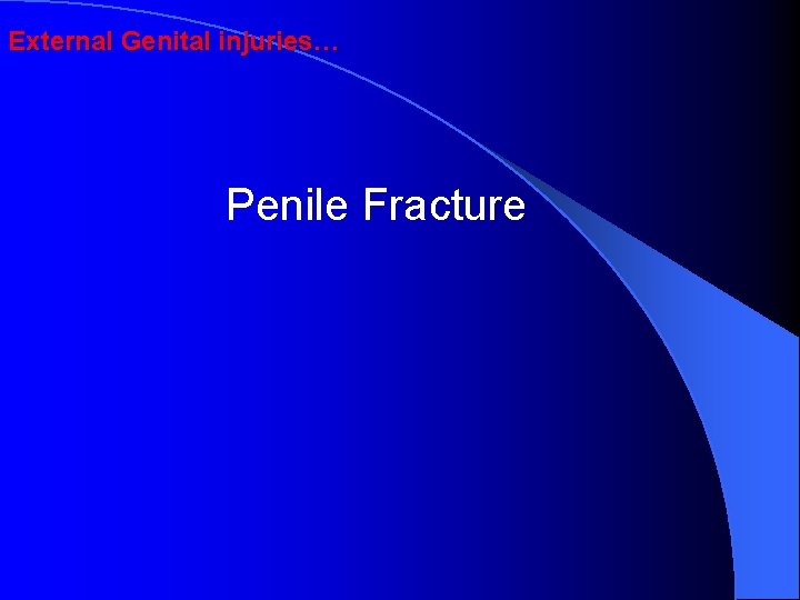 External Genital injuries… Penile Fracture 
