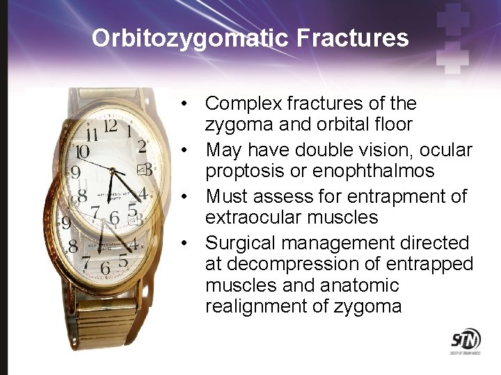 Orbitozygomatic Fractures • Complex fractures of the zygoma and orbital floor • May have