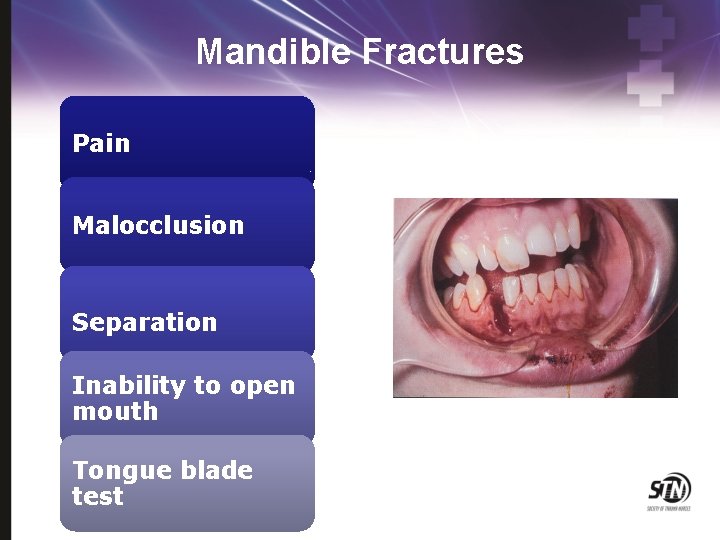 Maxillofacial and Ocular Injuries Objectives At the conclusion
