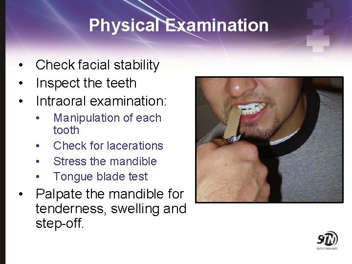 Physical Examination • Check facial stability • Inspect the teeth • Intraoral examination: •
