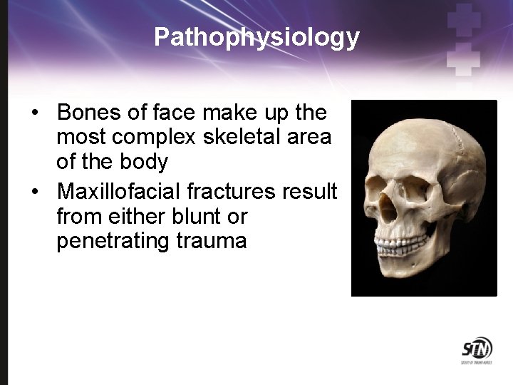 Pathophysiology • Bones of face make up the most complex skeletal area of the