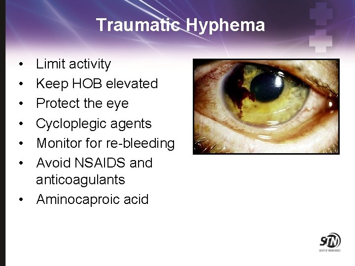 Traumatic Hyphema • • • Limit activity Keep HOB elevated Protect the eye Cycloplegic