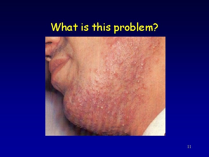 What is this problem? 11 