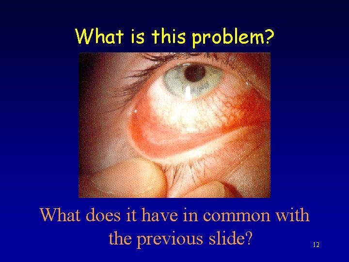 What is this problem? What does it have in common with the previous slide?