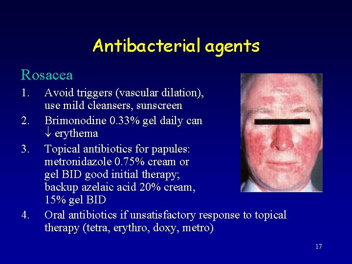 Antibacterial agents Rosacea 1. 2. 3. 4. Avoid triggers (vascular dilation), use mild cleansers,