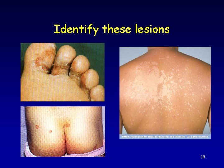 Identify these lesions 19 