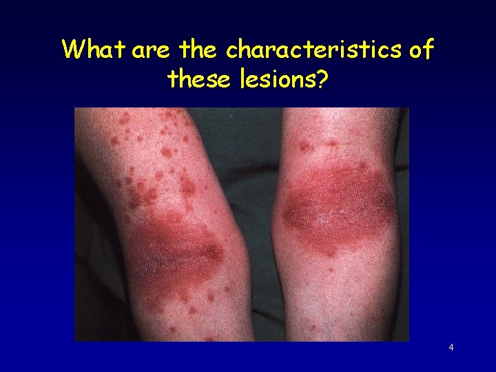 What are the characteristics of these lesions? 4 