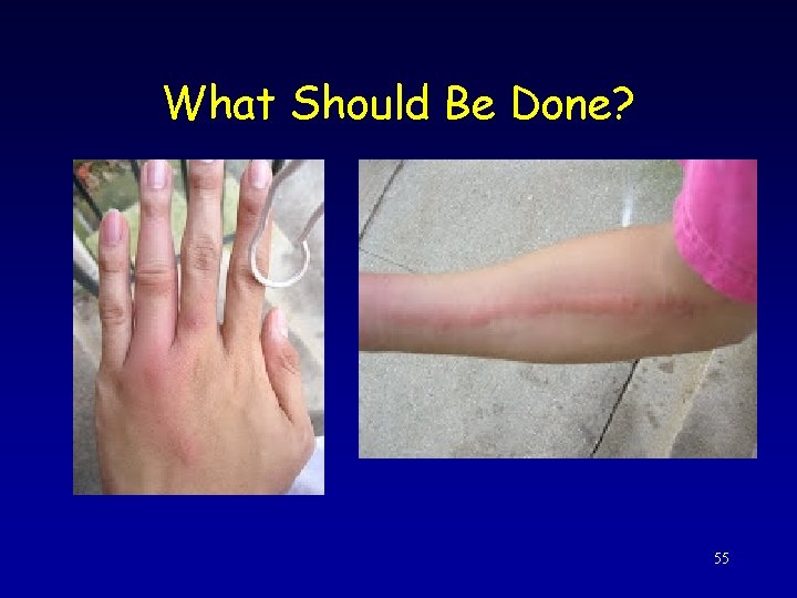 What Should Be Done? 55 