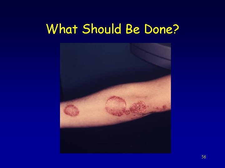 What Should Be Done? 56 