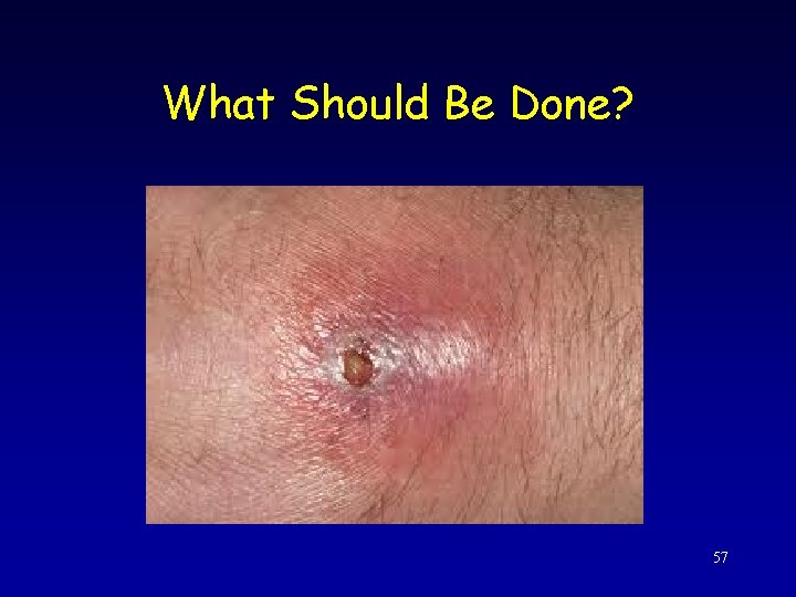 What Should Be Done? 57 