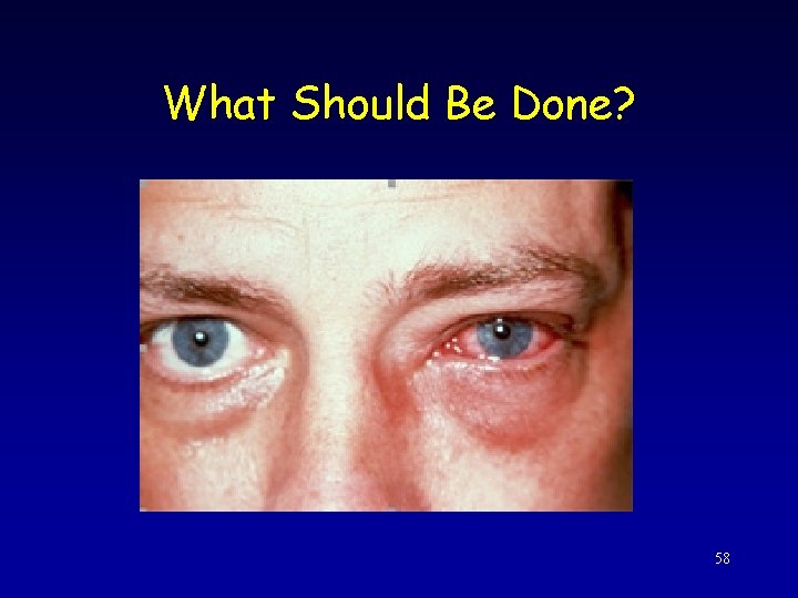 What Should Be Done? 58 