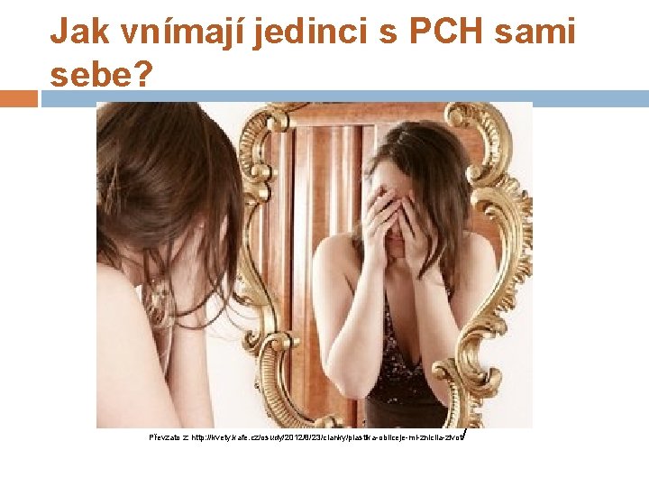 Jak vnímají jedinci s PCH sami sebe? Převzato z: http: //kvety. kafe. cz/osudy/2012/8/23/clanky/plastika-obliceje-mi-znicila-zivot /