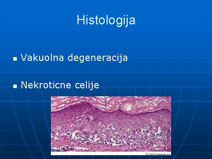 Histologija n Vakuolna degeneracija n Nekroticne celije 