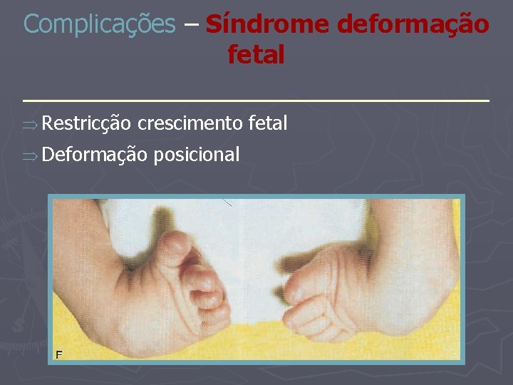 Complicações – Síndrome deformação fetal _______________ Restricção crescimento fetal Deformação posicional 