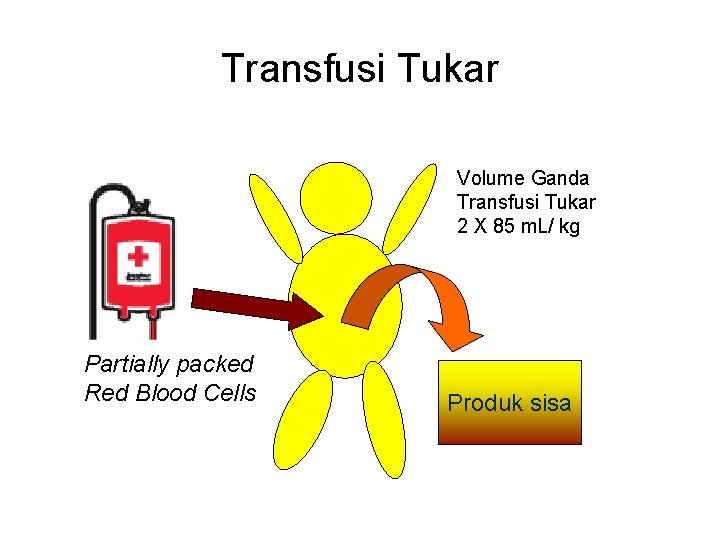 Transfusi Tukar Volume Ganda Transfusi Tukar 2 X 85 m. L/ kg Partially packed