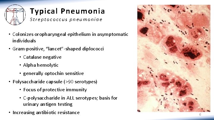 Typical Pneumonia Streptococcus pneumoniae • Colonizes oropharyngeal epithelium in asymptomatic individuals • Gram-positive, “lancet”-shaped