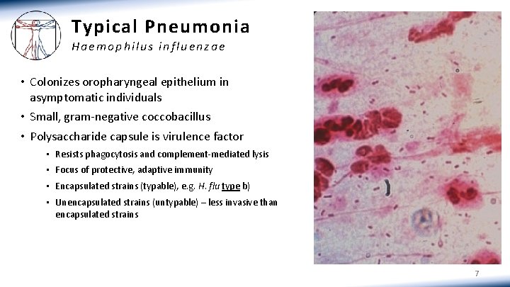Typical Pneumonia Haemophilus influenzae • Colonizes oropharyngeal epithelium in asymptomatic individuals • Small, gram-negative Typical Pneumonia Haemophilus influenzae • Colonizes oropharyngeal epithelium in asymptomatic individuals • Small, gram-negative