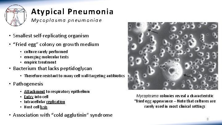 Atypical Pneumonia Mycoplasma pneumoniae • Smallest self-replicating organism • “Fried egg” colony on growth