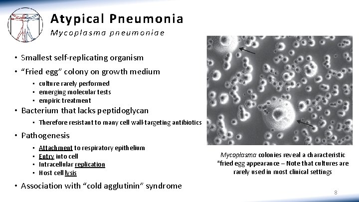 Atypical Pneumonia Mycoplasma pneumoniae • Smallest self-replicating organism • “Fried egg” colony on growth Atypical Pneumonia Mycoplasma pneumoniae • Smallest self-replicating organism • “Fried egg” colony on growth