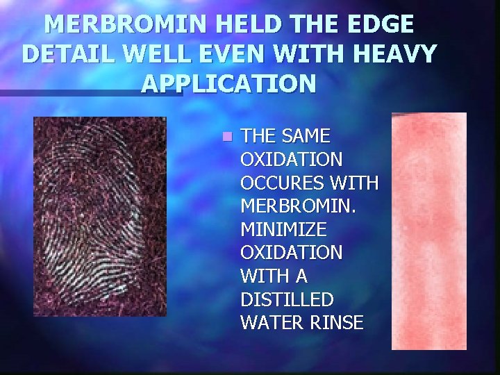 MERBROMIN HELD THE EDGE DETAIL WELL EVEN WITH HEAVY APPLICATION n THE SAME OXIDATION