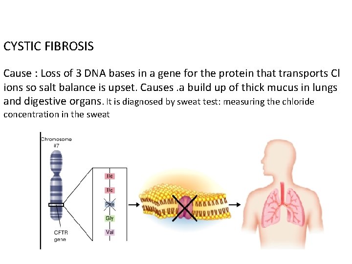 CYSTIC FIBROSIS Cause : Loss of 3 DNA bases in a gene for the
