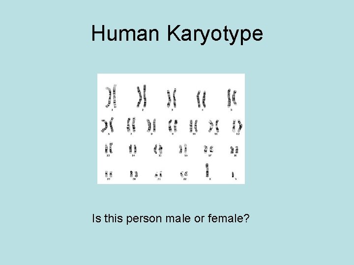 Human Karyotype Is this person male or female? 