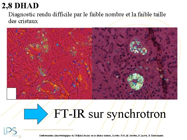 2, 8 DHAD Diagnostic rendu difficile par le faible nombre et la faible taille