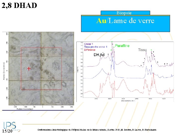 2, 8 DHAD Biopsie Au/Lame de verre 15/20 Confrontations clinicobiologiques de l’Hôpital Necker sur