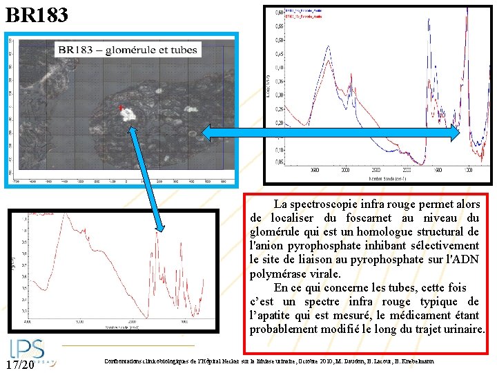 BR 183 La spectroscopie infra rouge permet alors de localiser du foscarnet au niveau