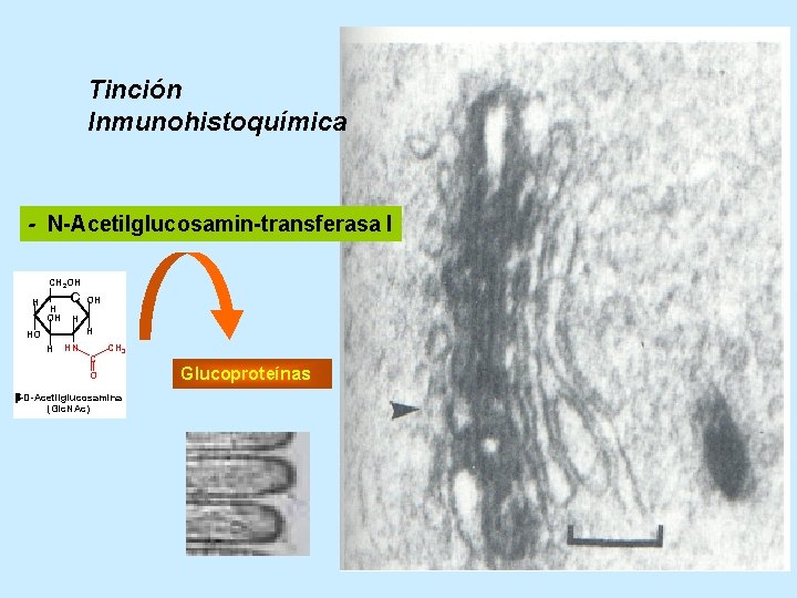 Tinción Inmunohistoquímica - N-Acetilglucosamin-transferasa I CH 2 OH H OH H HO H HN