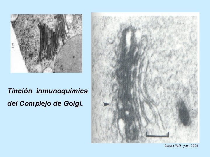 Tinción inmunoquímica del Complejo de Golgi. Becker, W. M. y col. 2000 