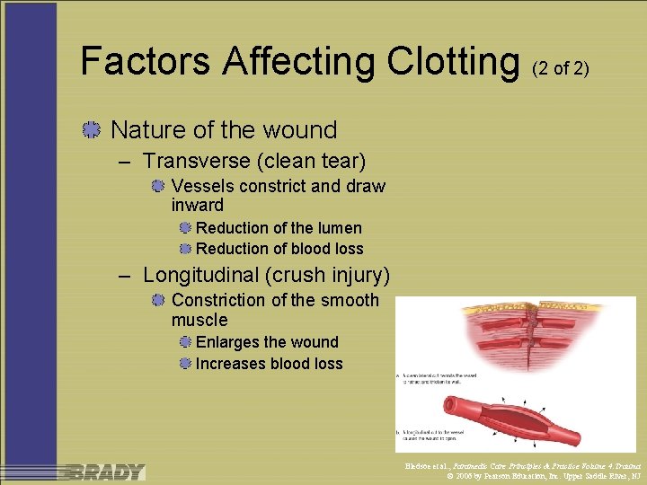 Factors Affecting Clotting (2 of 2) Nature of the wound – Transverse (clean tear)