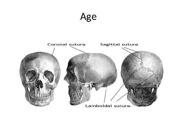 Age 