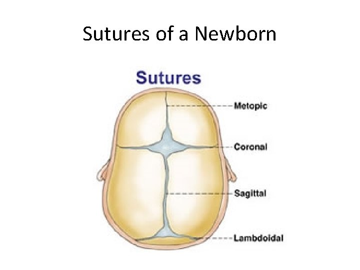 Sutures of a Newborn 