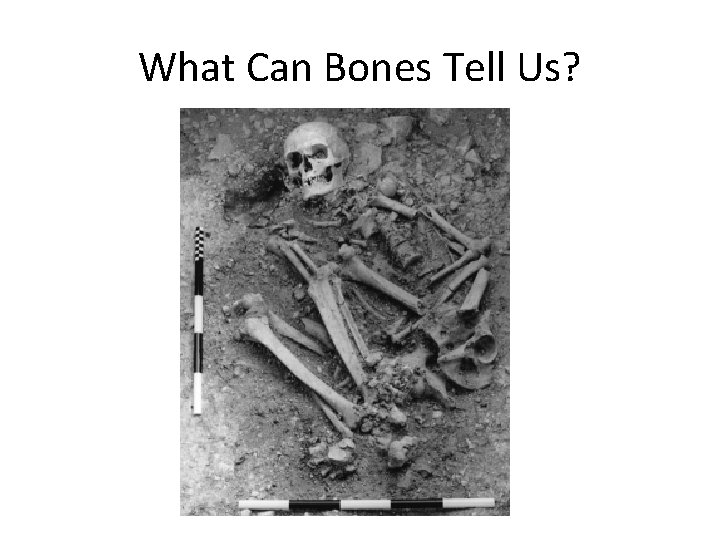 What Can Bones Tell Us? 