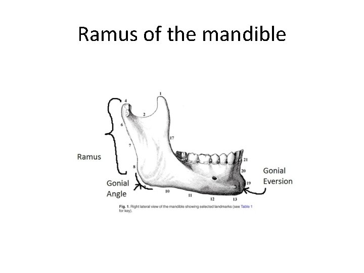 Ramus of the mandible 