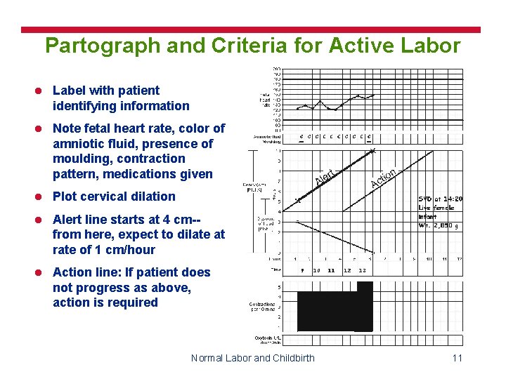 Partograph and Criteria for Active Labor l Label with patient identifying information l Note