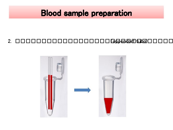 Blood sample preparation 2. ��������������� (eppendorf tube) 