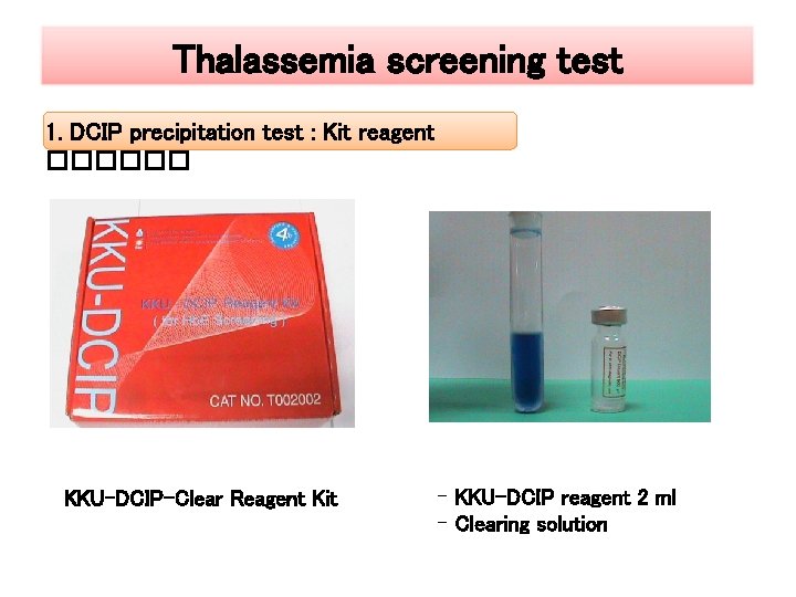 Thalassemia screening test 1. DCIP precipitation test : Kit reagent ������ KKU-DCIP-Clear Reagent Kit
