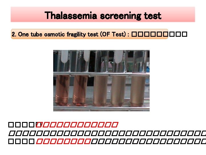 Thalassemia screening test 2. One tube osmotic fragility test (OF Test) : �������� ���������������