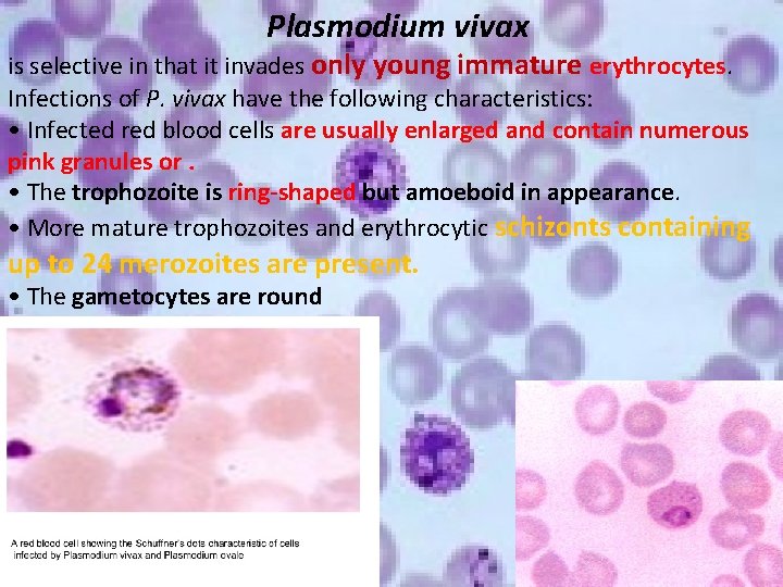 Plasmodium vivax is selective in that it invades only young immature erythrocytes. Infections of