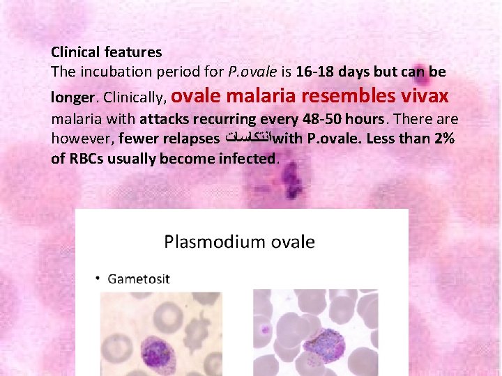 Clinical features The incubation period for P. ovale is 16 -18 days but can