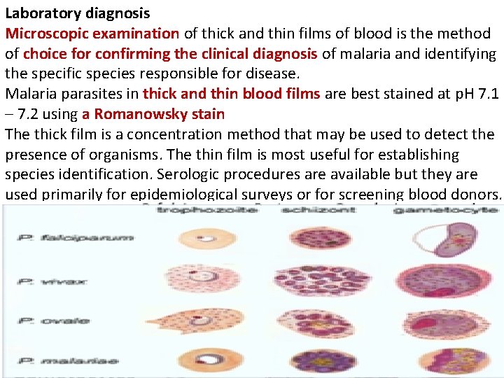 Laboratory diagnosis Microscopic examination of thick and thin films of blood is the method