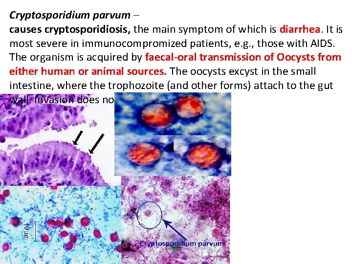 Cryptosporidium parvum – causes cryptosporidiosis, the main symptom of which is diarrhea. It is
