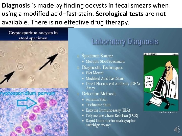 Diagnosis is made by finding oocysts in fecal smears when using a modified acid–fast