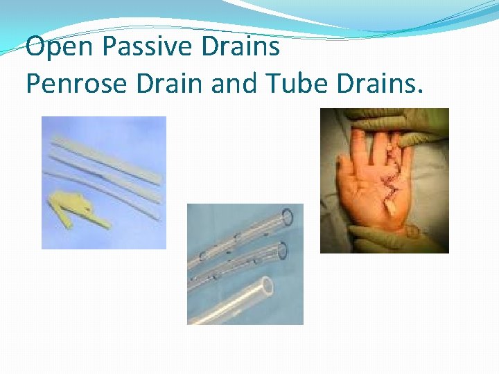 Drains Ostomies and Wound Products By Mark Vance